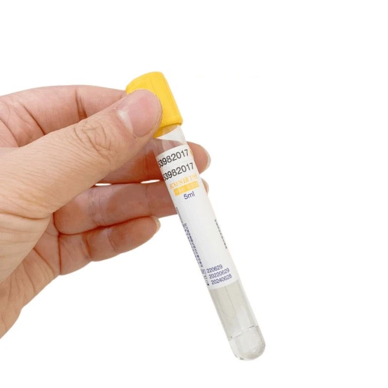 Jednorazowa probówka próżniowa – Medical Lab Blood Test recenzja i cena