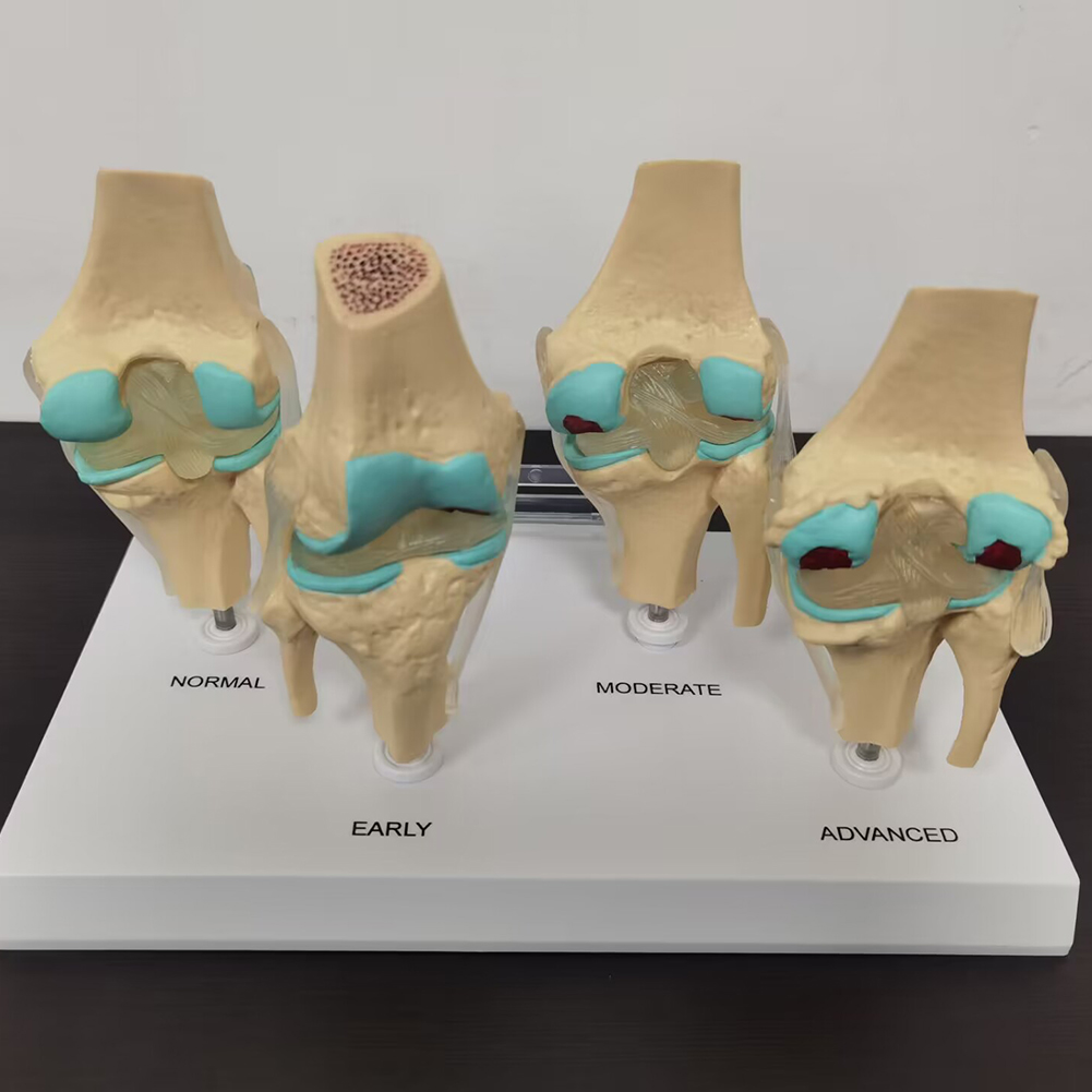 4-stopniowy model staw kolanow – Medical Lab Technology recenzja i cena