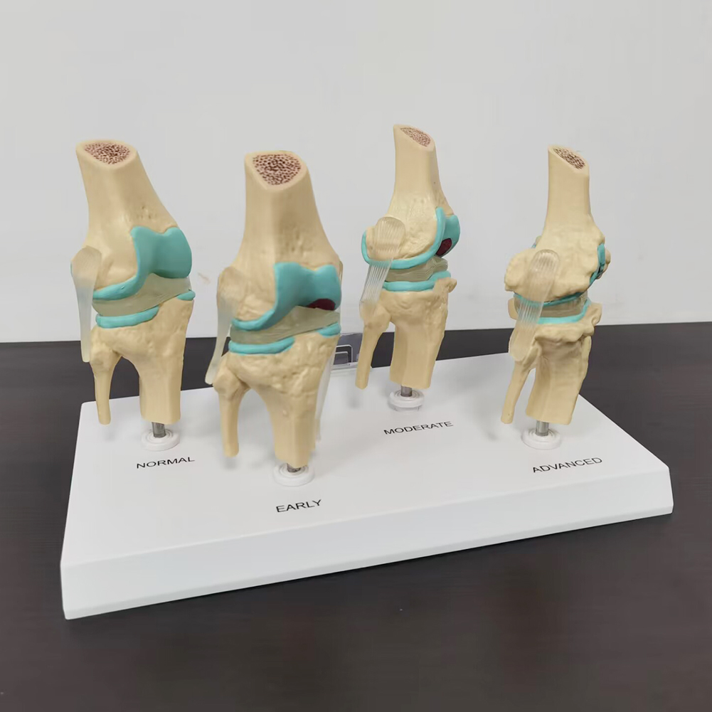 4-stopniowy model staw kolanow – Medical Lab Technology recenzja i cena